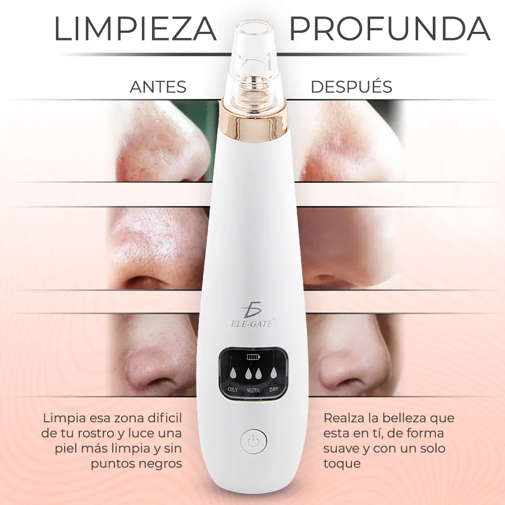 Limpiador De Poros Extractor De Espinillas Por Succión 6 Cabezas